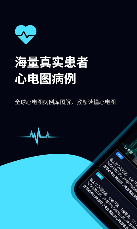 心电图ECG